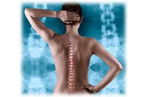 Spine fusion